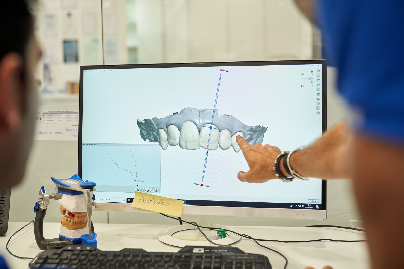 Ontwerp en analyse van prothetisch werk